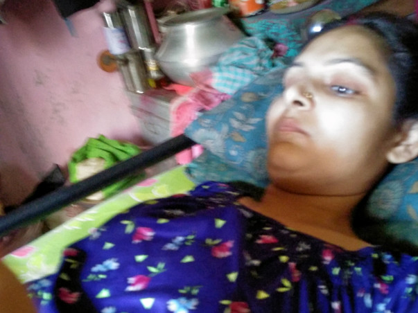 Fighting With NMOSD For My Wife Manju Shaw