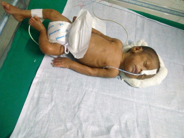 Help Baby suba fighting for life