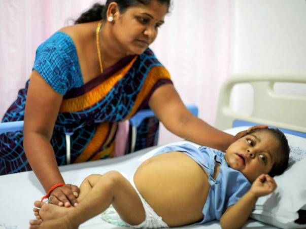 This 1-Year-Old Baby Girl Won't Survive Without A Liver Transplant