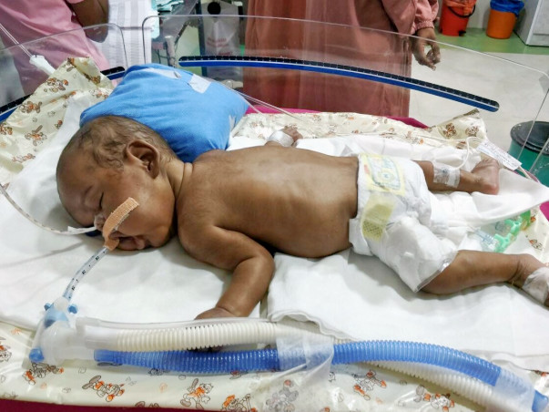 Help Baby of Karthika to See World After an Year of Struggle