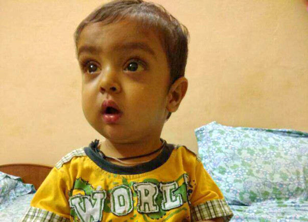Help Shivansh Undergo a Liver Transplant