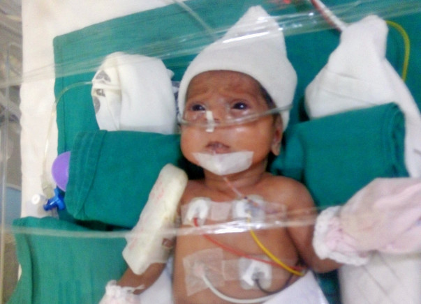 Help Preterm Twins Of Pallavi Suffering From Chronic Lung Disease