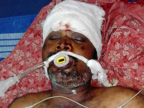 Help Sankar Recover From Road Accident