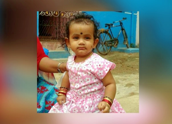 Save Baby Akshaya From Severe Scald Burns