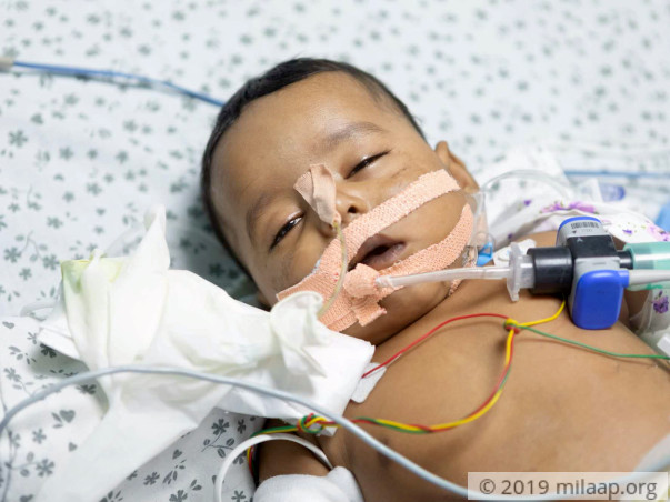 Jasvin Nagineni is in the ICU and need your help to survive