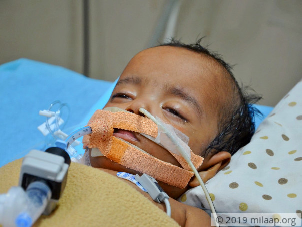 1-year old Arshiya needs your support to fight disease