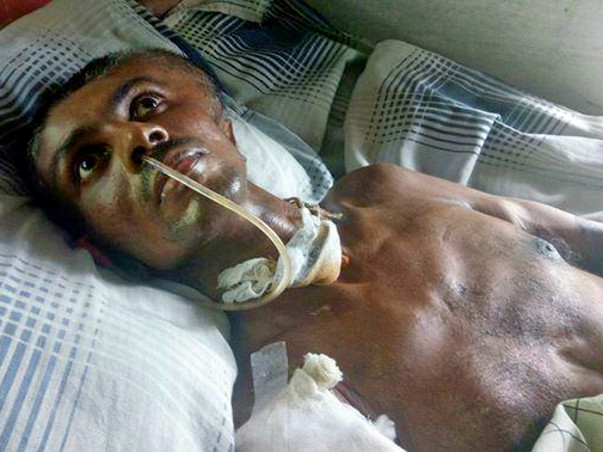 Help Manoj And His Family Live A Life With Dignity