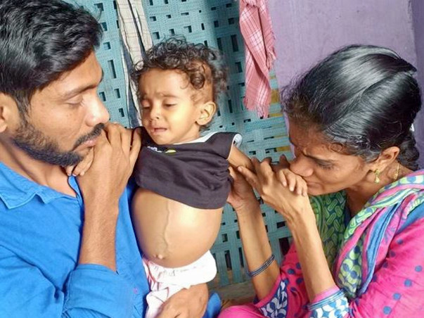 Help Baby Lucky Undergo A Liver Transplant