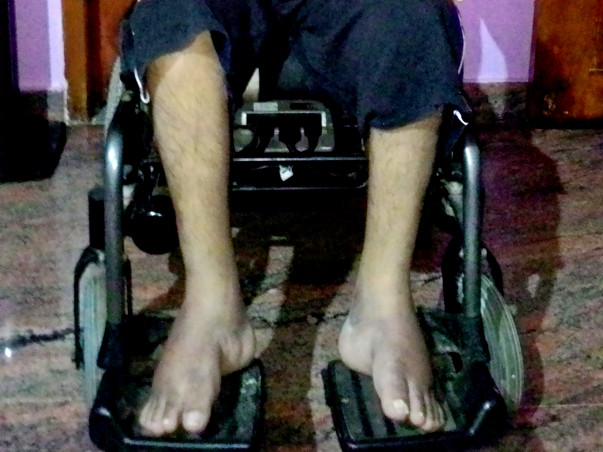 Please help me to fight against motor neurone disease(ALS)