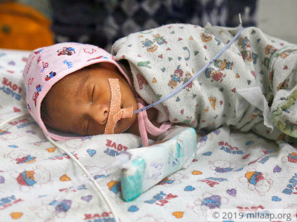 15-day-old Baby Has Only 6 Days To Get A Heart Surgery And Survive