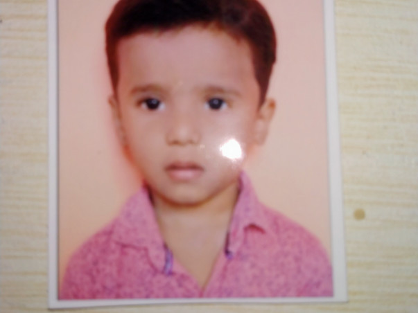Help Baby Sumant For Cochlear Implant