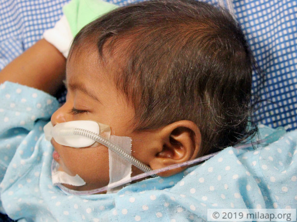 6-Month-Old Baby's Liver And Lungs Are Severely Infected, Needs Help