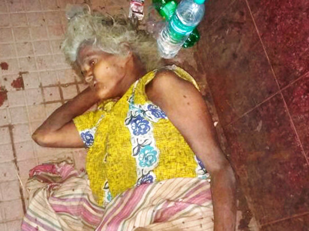 On Hospital's Death Bed With A Head Full Of Maggots, Please Save Her