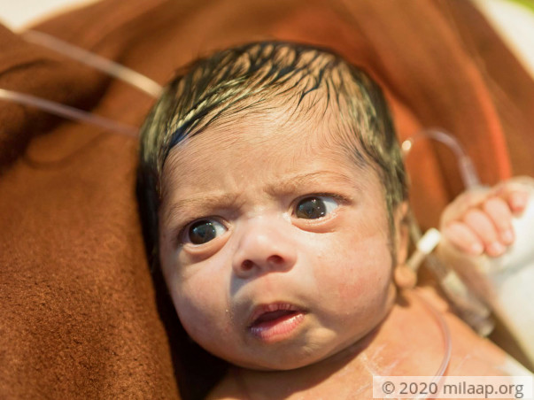 With A Scar Almost As Big As He Is, This Baby Is Struggling To Survive