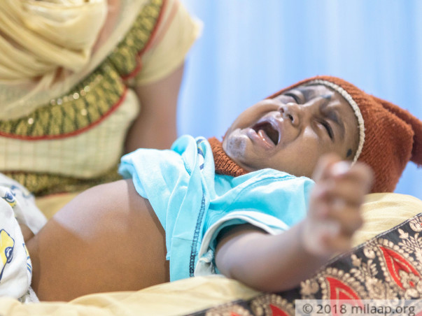 8-Month-Old's Severely Damaged Liver Doesn't Let Him Breathe