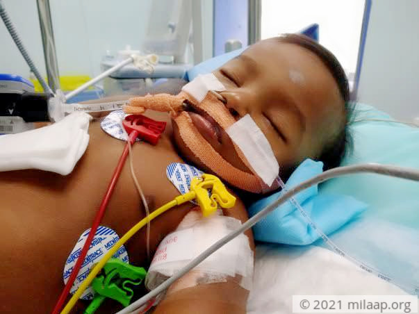 6-month-old’s Fever Escalated Into Liver Damage In Hours