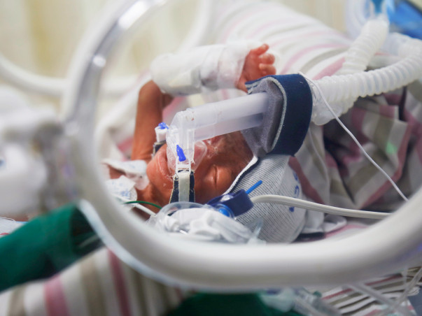 Petrol Pump Worker Races To Save 3Months Premature Born Twin Daughters