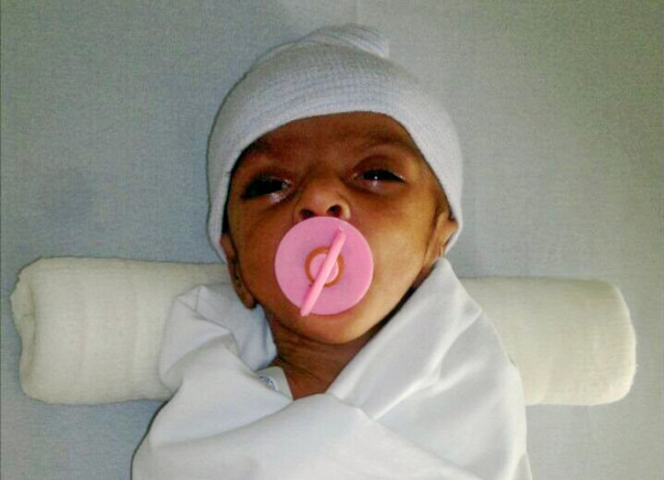 Help Pratyush for open heart surgery & mitral valve repair