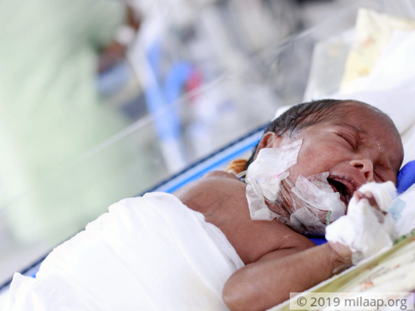 Hotel Worker Struggles To Save 2-Month-Old From Deadly Disease