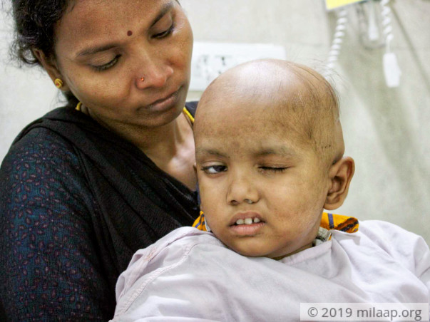 Help Ishan Fight Brain Tumor