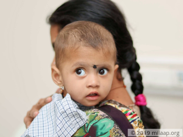 Her Parents' Poverty May Not Let This Baby Girl Get A Healthy Liver