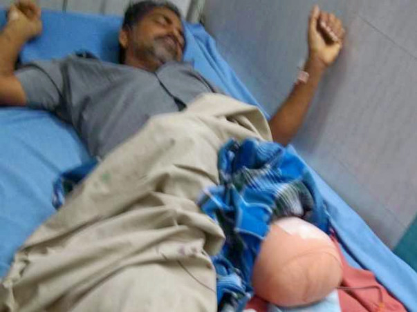 Help Mahalakshmiya- met with an accident - left leg removed