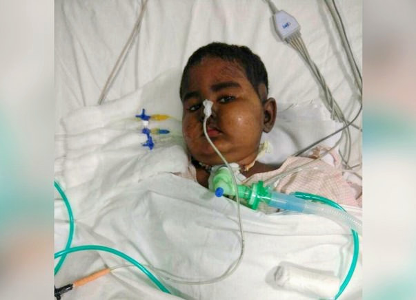 SAVE BABY KAYALVIZHI FROM CANCER !