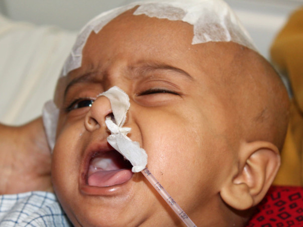10-Month-Old Needs Treatment To Heal From Brain Injury