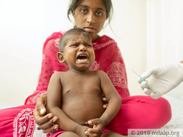 2-year-old Will Scratch Himself To Death Without Liver Transplant