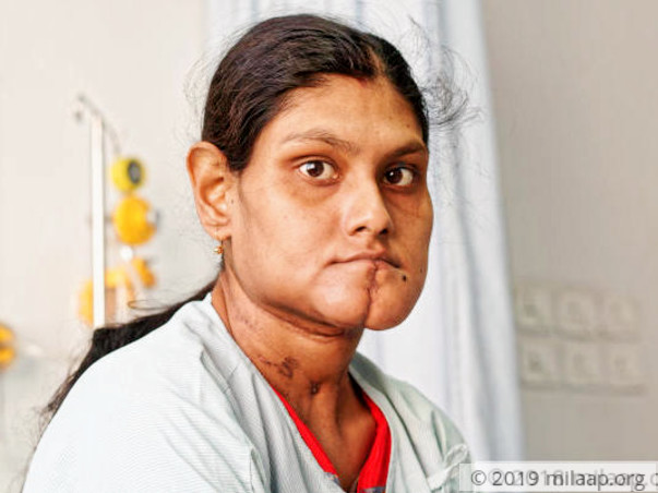 Paramita needs your support to undergo her treatment