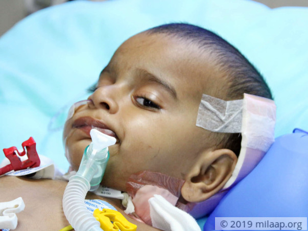 Sharvesh's brain tumor has paralysed him, he needs help to live
