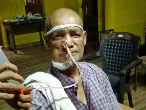 Help Shashiraj Fight Mouth Cancer