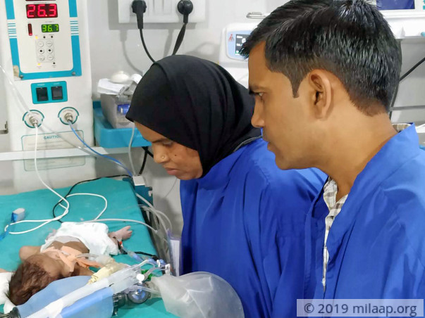 Baby of Khushnuma needs your help to survive