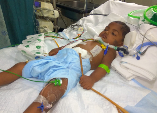 Their Child May Not Be Normal Anymore, Still They Wish To Save Him
