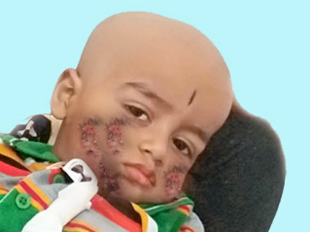 Help My Child Who Fight With His Disease To "Alive"