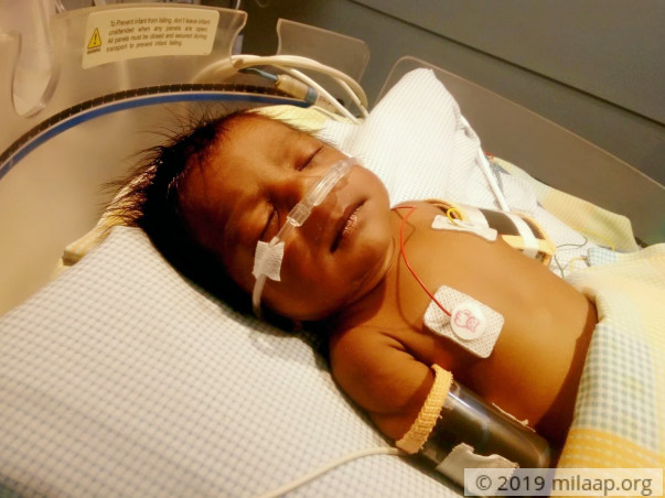 This 1-month-old's Heart Will Stop Beating Without An Urgent Surgery