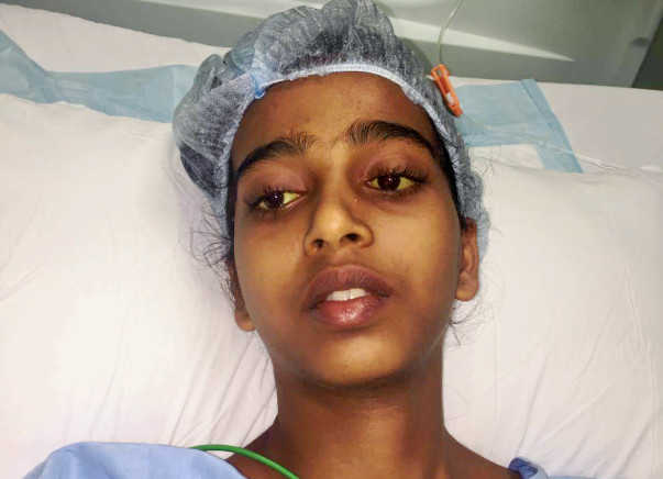 Family Seeks Support For Their 15-Year-Old Daughter's Liver Transplant