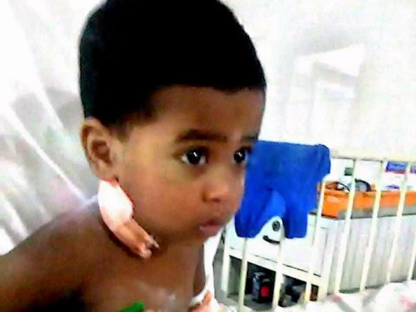 Help Jaswanth From Cancer
