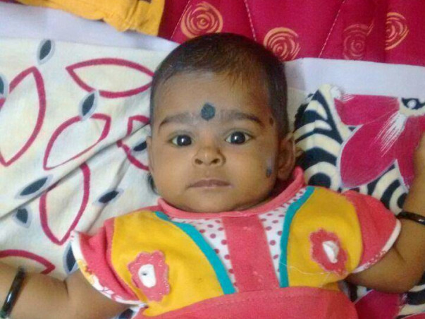 Help Baby Ridhi Undergo A Liver Transplant