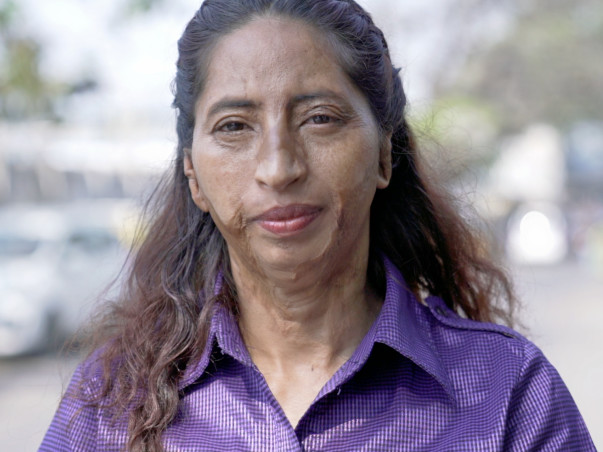 Giving New Hope To India's Acid Attack Victims
