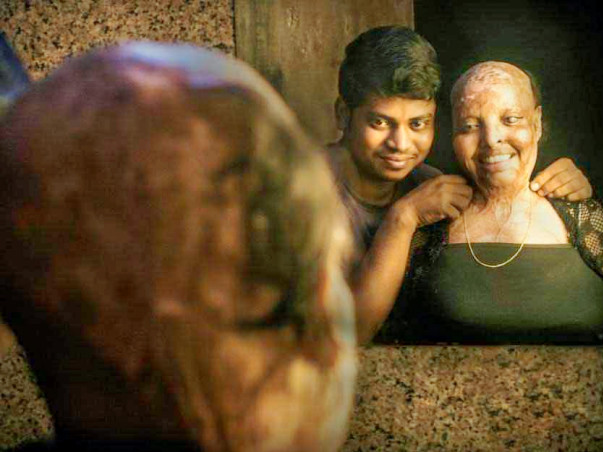 In the name of love for acid attack survivor Rani