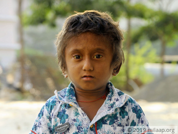 Boy Living On ORS Due To Failing Liver Needs Your Help To Survive