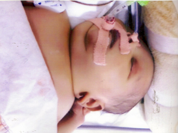 Help baby of Ramya get treatment for Sepsis
