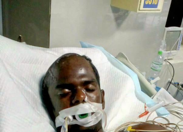 Severe head injury for my brother.He is in very critical stage.Help us