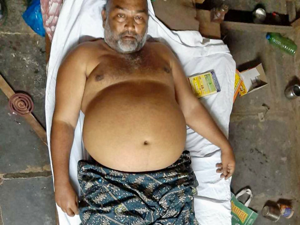 Need Support For Vijay Kumar, He Is Suffering Kidney And Filaria