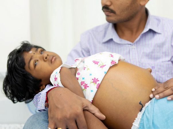 3-year-old's Stomach Is Swollen To The Size Of A Football