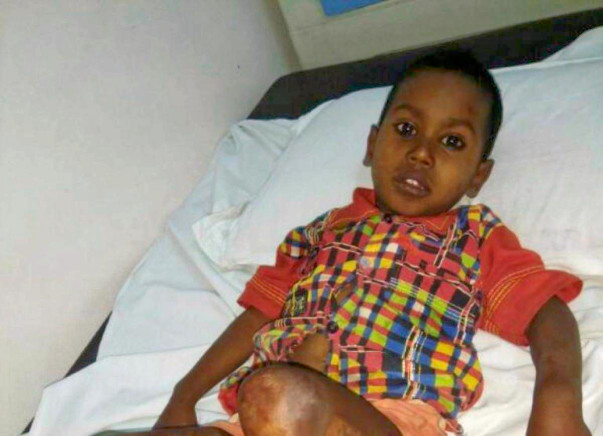 HELP BABY KARAN RECOVER FROM HIS PAIN!