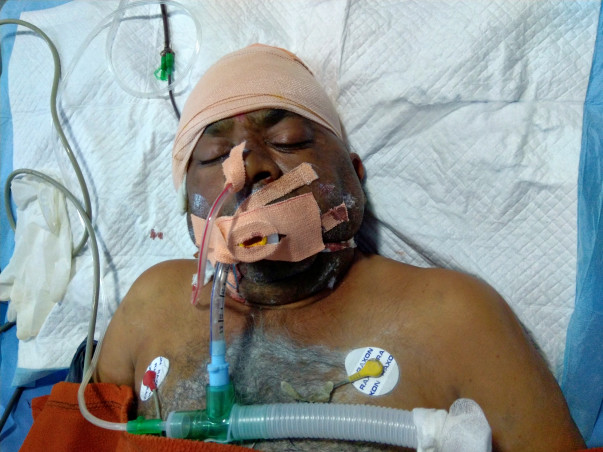 Help Sudam Undergo Neurosurgery