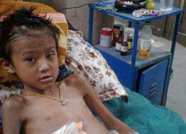 Help this 8 year old brave boy from losing his leg to gangrene
