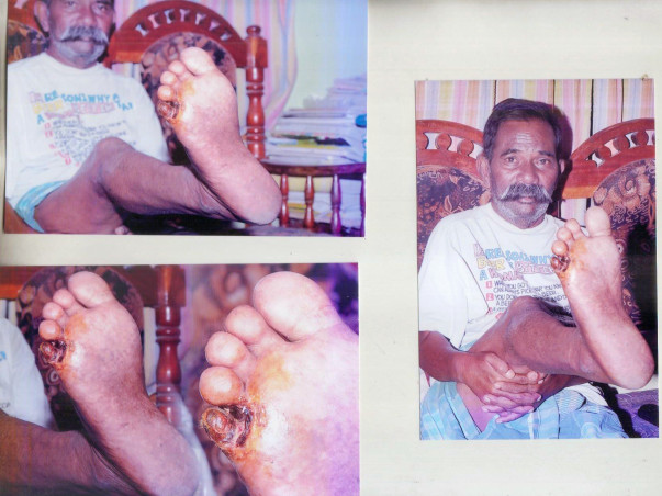 Help me to fight blocked veins ( Right leg to Heart )